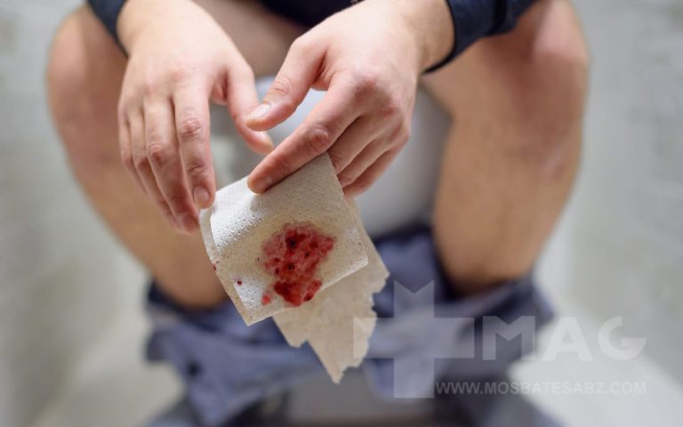 خون در مدفوع