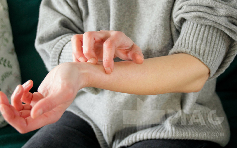 علت خارش بدن