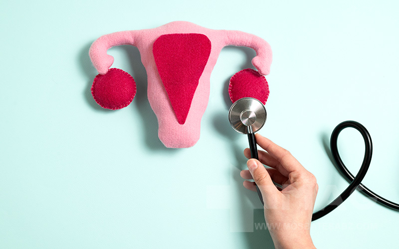 سرطان تخمدان