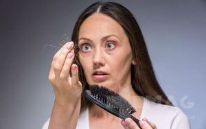 آیا دیابت باعث ریزش مو میشود