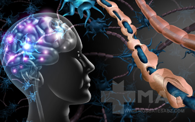 بیماری ام اس