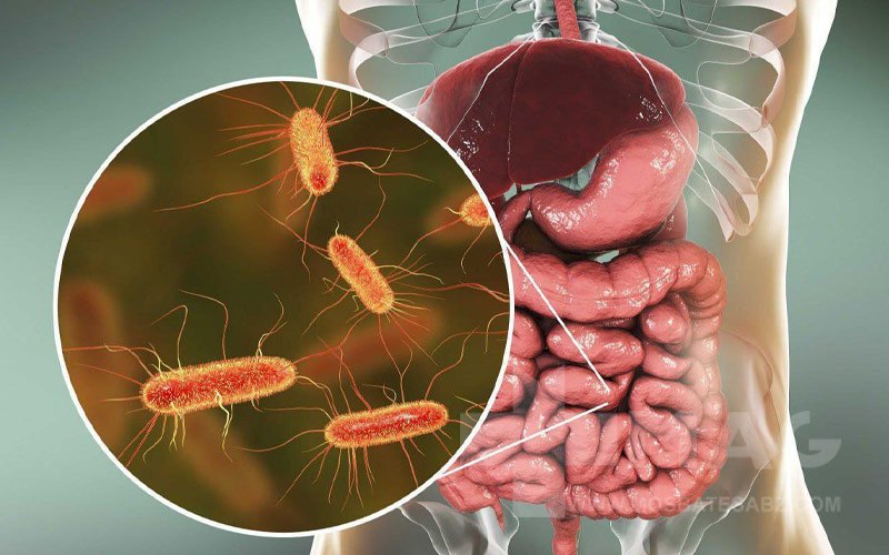 درمان رشد بیش از حد باکتری های روده کوچک
