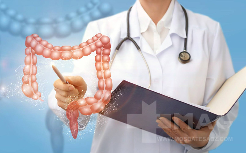 درمان پولیپ روده