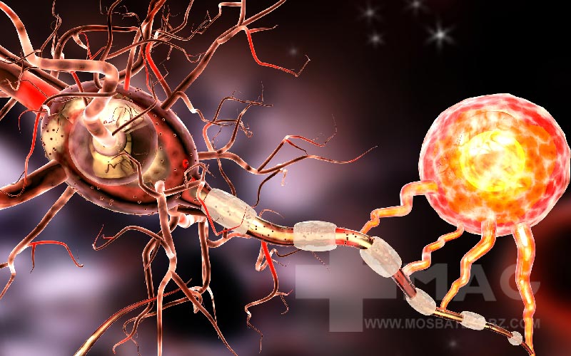 داروهای ام اس