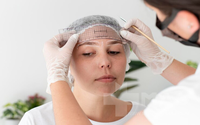 لیفت ابرو: بررسی بهترین روش‌ها، مزایا، معایب و هزینه‌ها