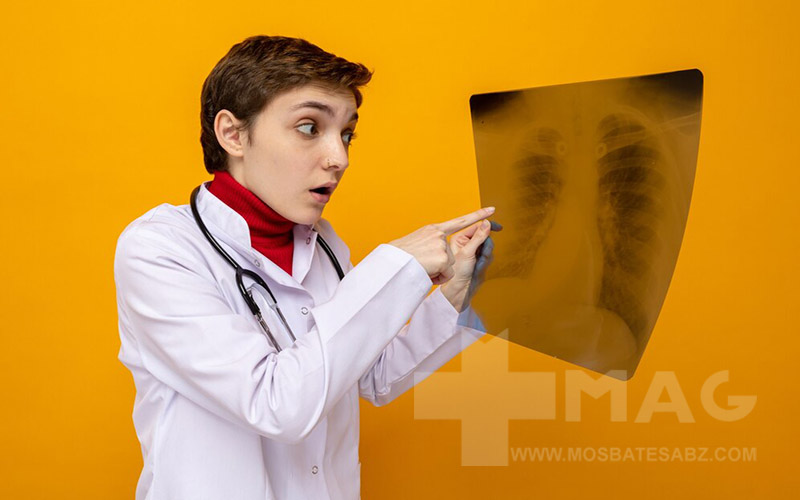 آیا بیماری سل خطرناک است