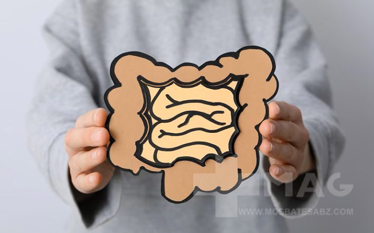 شکل مدفوع در سندروم روده تحریک‌پذیر