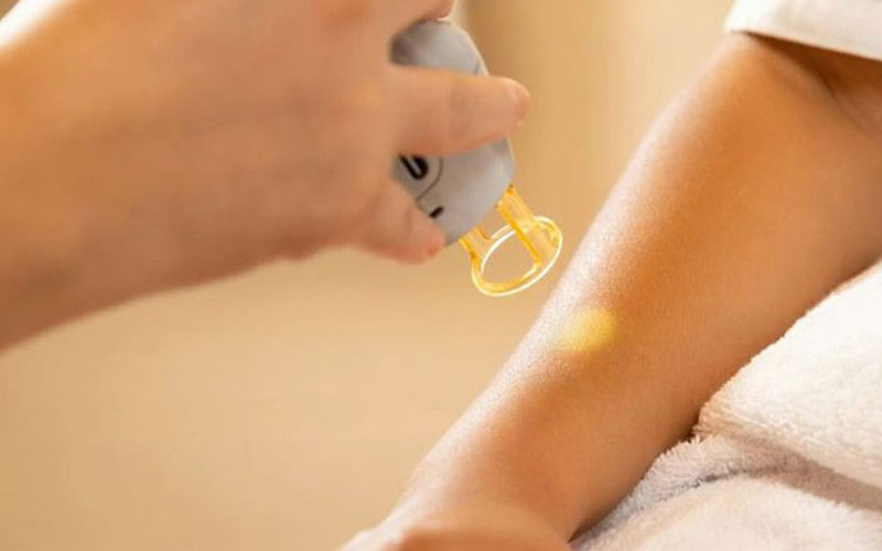 بهترین مرکز لیزر تهران