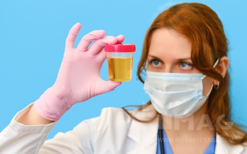 ادرار بد بو نشانه چیست