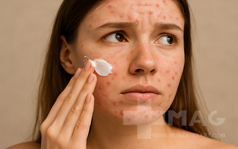 جوش زدن با آبرسان