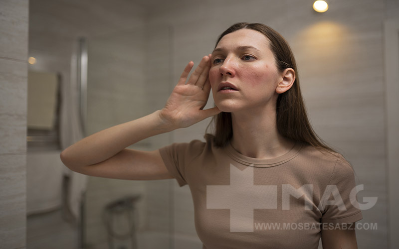 قرمزی صورت و آلرژیدر اثر خوردن بالم لب