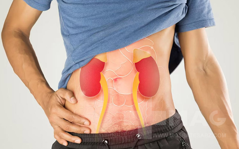 عوارض کراتین بر کلیه ها