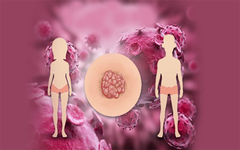 راه های انتقال اچ پی وی - (1)