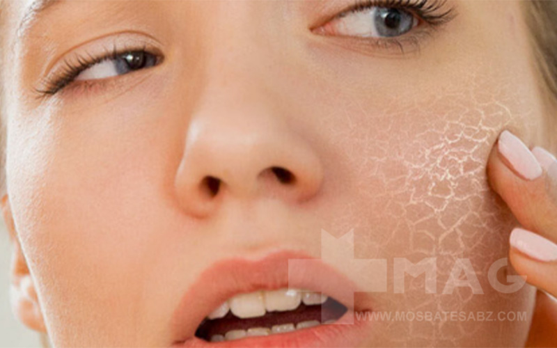 نحوه استفاده از سرم نیاسینامید