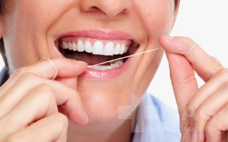 نخ دندان چیست