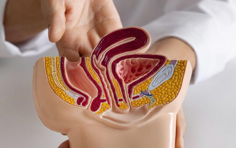 پرینورافی - تصویر 1 (1)