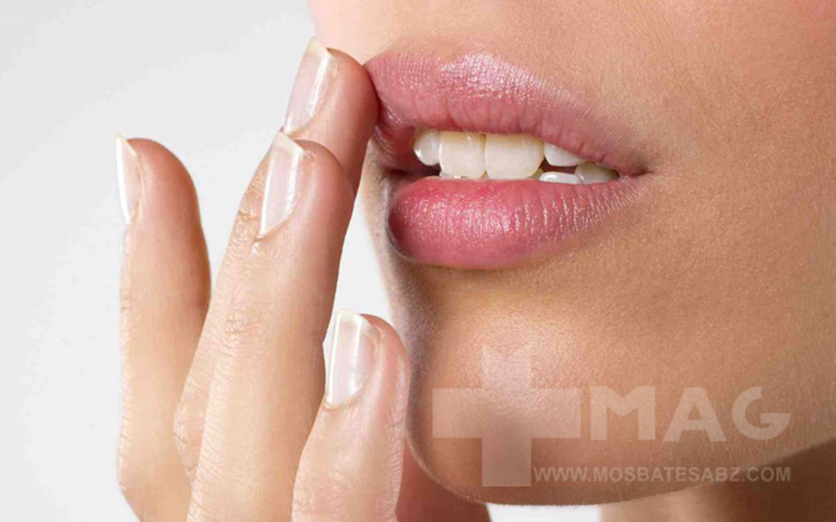 علت ورم لب بالا در صبح