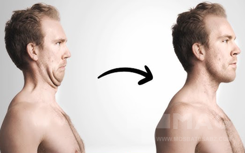 حرکات اصلاحی گردن ، چیندادن چانه