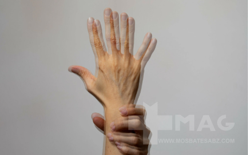 درمان لرزش شدید بدن