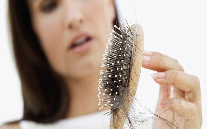 انواع ریزش مو