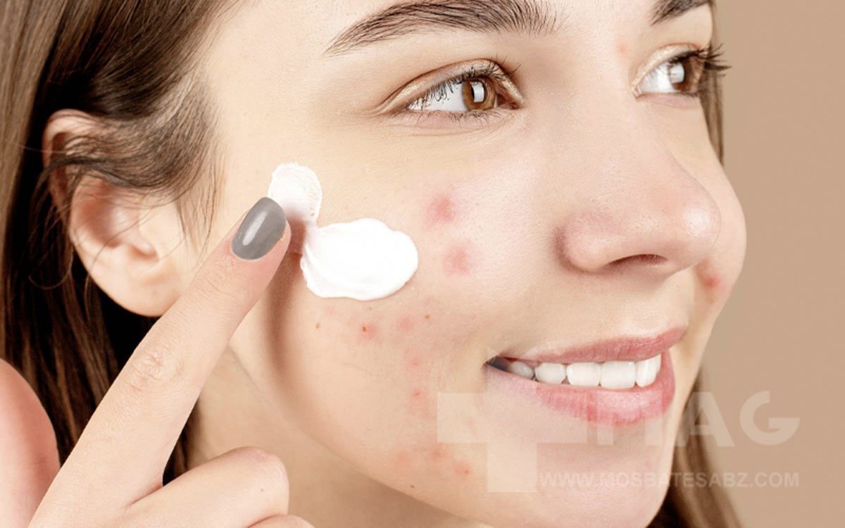 قرص آسپرین برای پوست