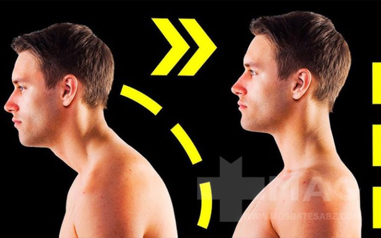 حرکات اصلاحی گردن