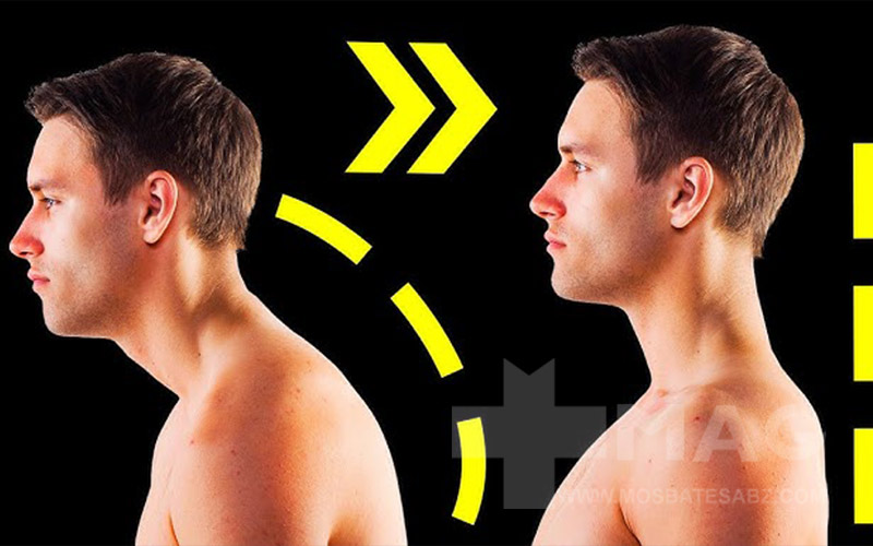 حرکات اصلاحی گردن