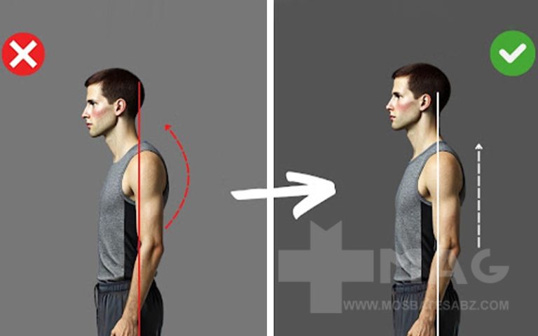 درمان افتادگی شانه با تمرین