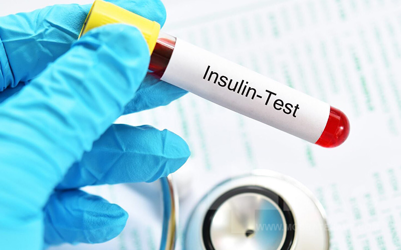 ارتباط ALA با مقاومت به انسولین و سندرم متابولیک