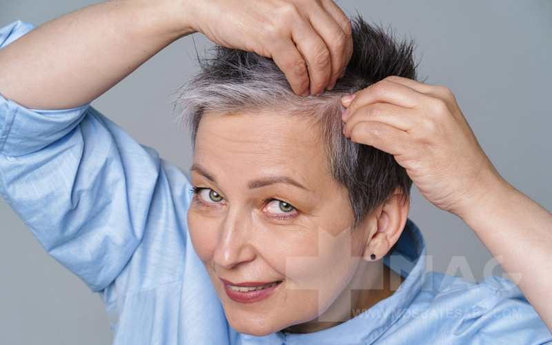 رفع سفیدی مو از ریشه