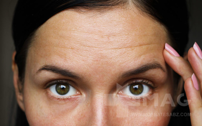 خداحافظی با چین‌وچروک