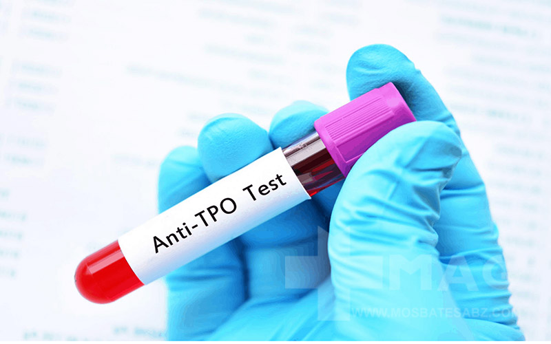 آزمایش تیروئید و 7 فاکتور آن