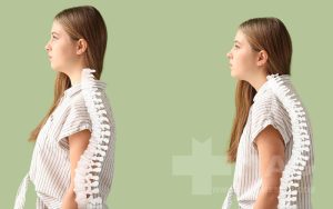 حرکات بدنسازی برای رفع قوز کمر