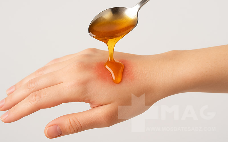 عسل به عنوان ضدباکتری طبیعی