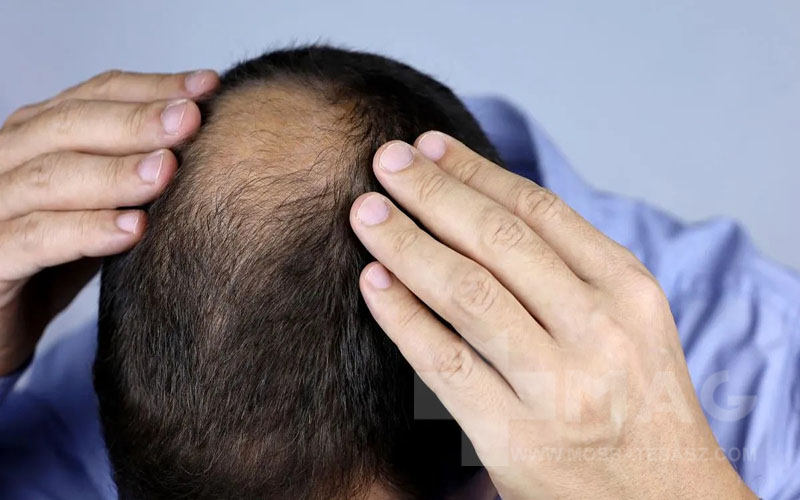 مصرف دارو یا بیماری‌های زمینه‌ای