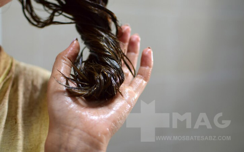 چرب شدن و احتمال ریزش مو