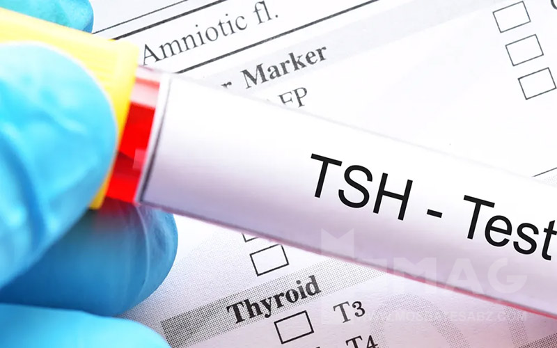 آزمایش تیروئید و 7 فاکتور آن