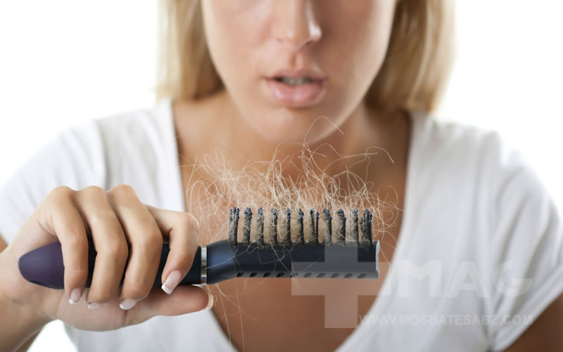 درمان ریزش مو در زنان