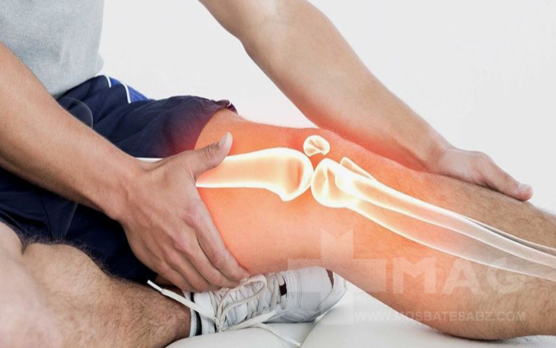 بهترین مکمل برای آرتروز زانو کدام است.