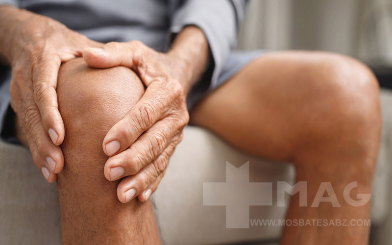 بهترین مکمل برای آرتروز زانو کدام است؟