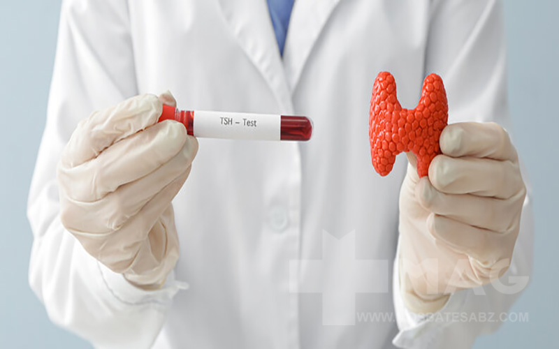آزمایش تیروئید و 7 فاکتور آن