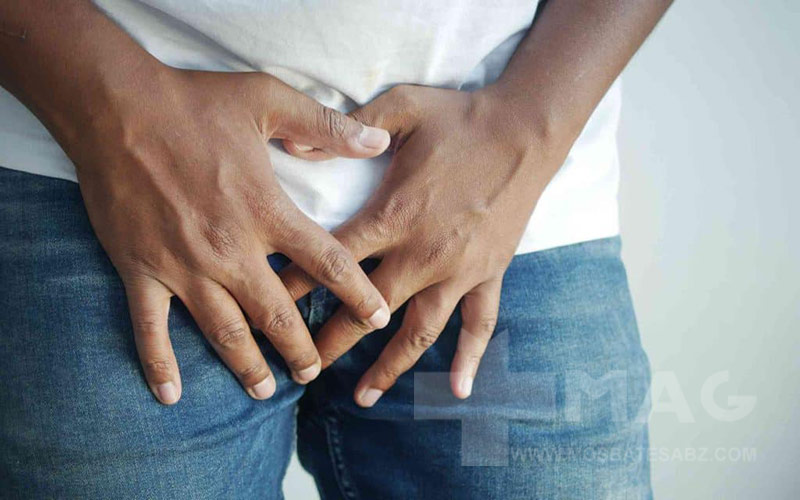 دلایل ایجاد اگزما در ناحیه تناسلی 