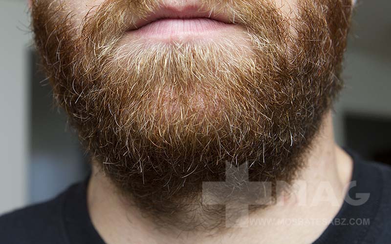 بهترین دارو برای پرپشت شدن ریش