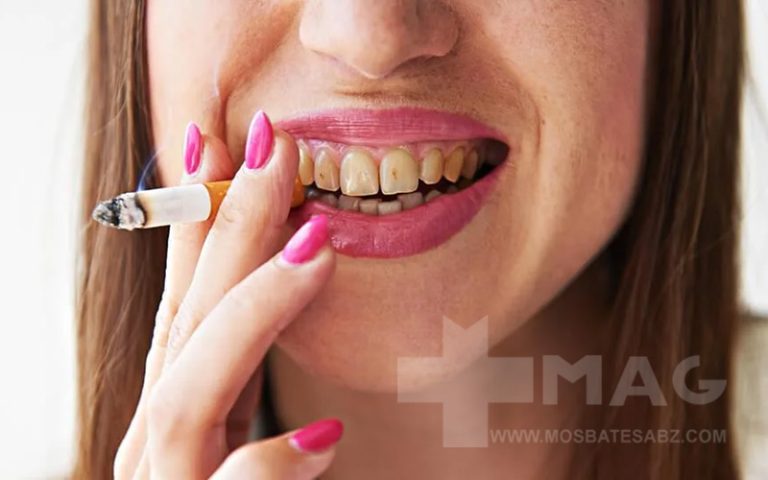 بهترین خمیر دندان برای افراد سیگاری