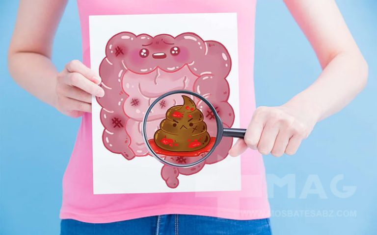 علت مدفوع تکه تکه و باریک چیست