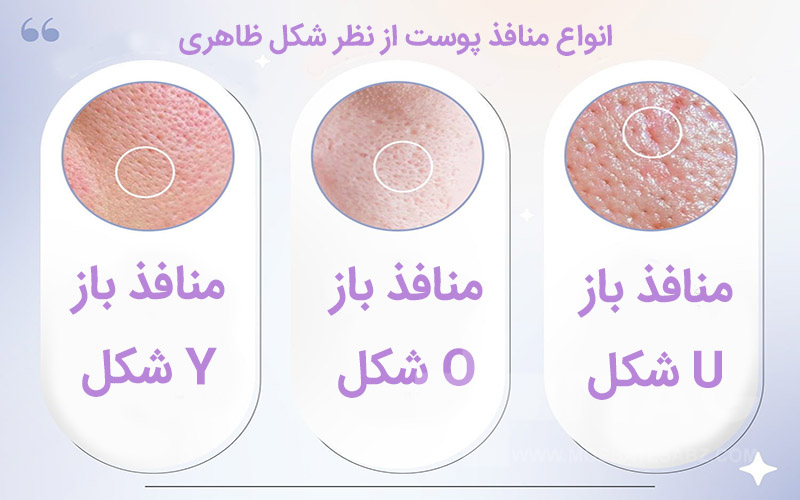 انواع منافذ باز پوست از نظر شکل ظاهری