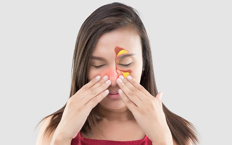 درمان سرفه خشک ناشی از سینوزیت