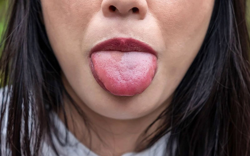 گاز گرفتن زبان در خواب