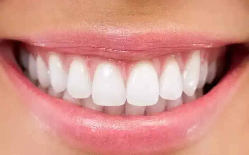 نقش افزایش سن در تیره شدن دندان نیش