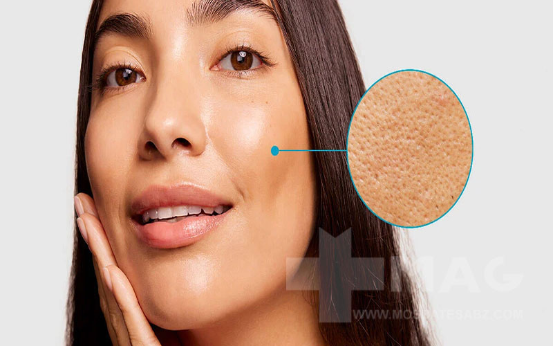 علت باز شدن منافذ پوست